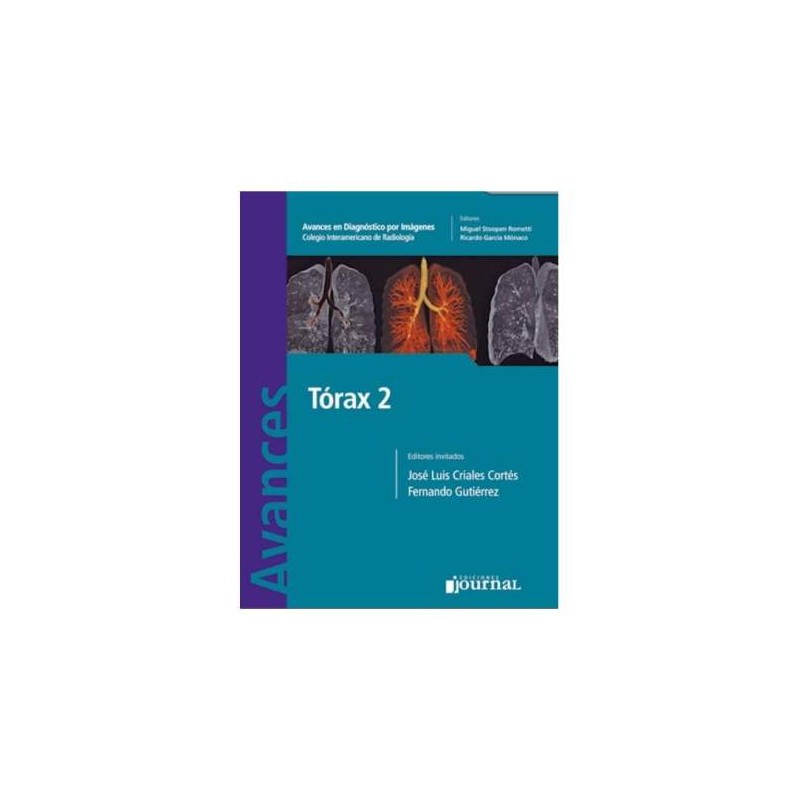 AVANCES DIAGNOSTICO IMAGENES TORAX 2