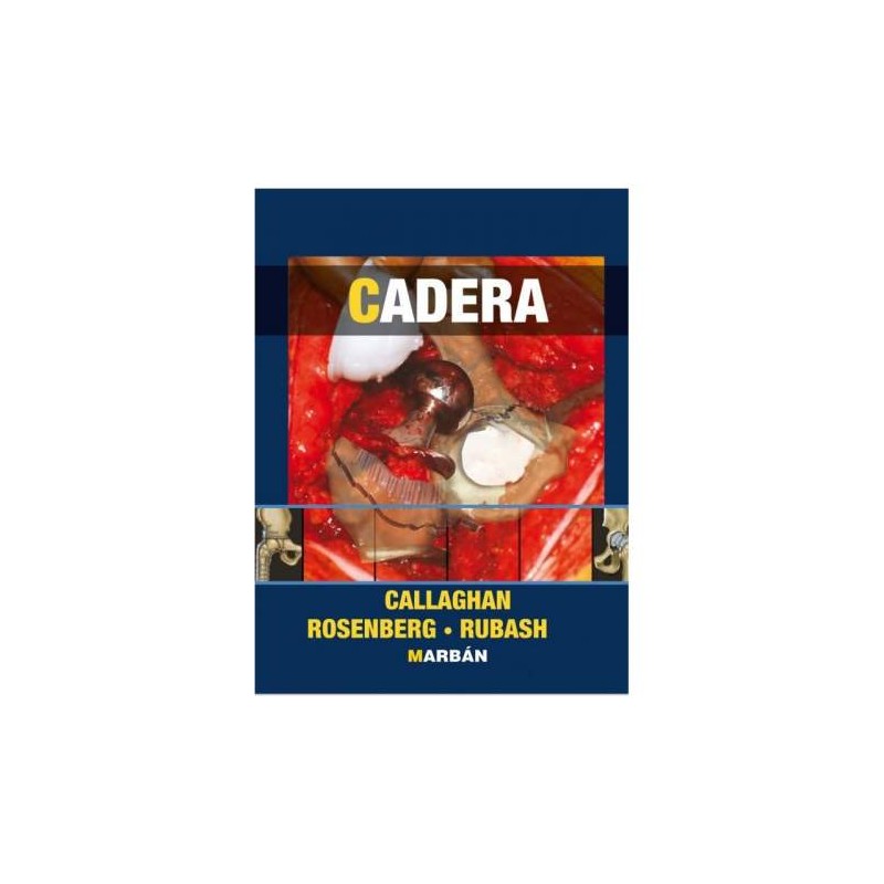CADERA TAPA DURA