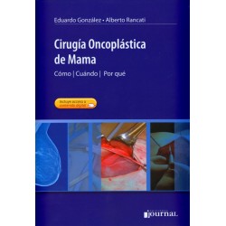 CIRUGIA ONCOPLASTICA MAMA 2013